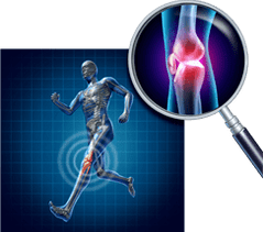 Arthrose van het kniegewricht